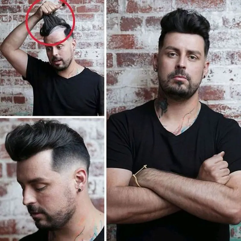 Система волос без узлов для мужчин - Фотография_6