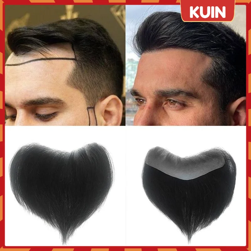 Invisble hairline v стиль передний
